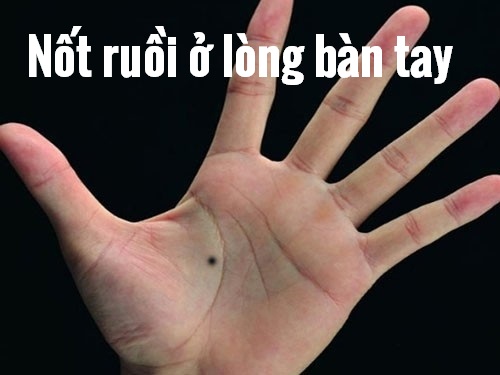 Not ruoi o long ban tay