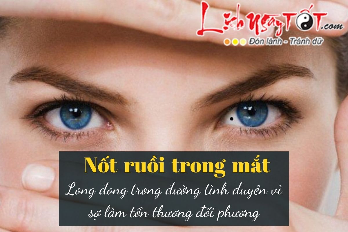 Not ruoi trong mat la not ruoi dao hoa o nu gioi