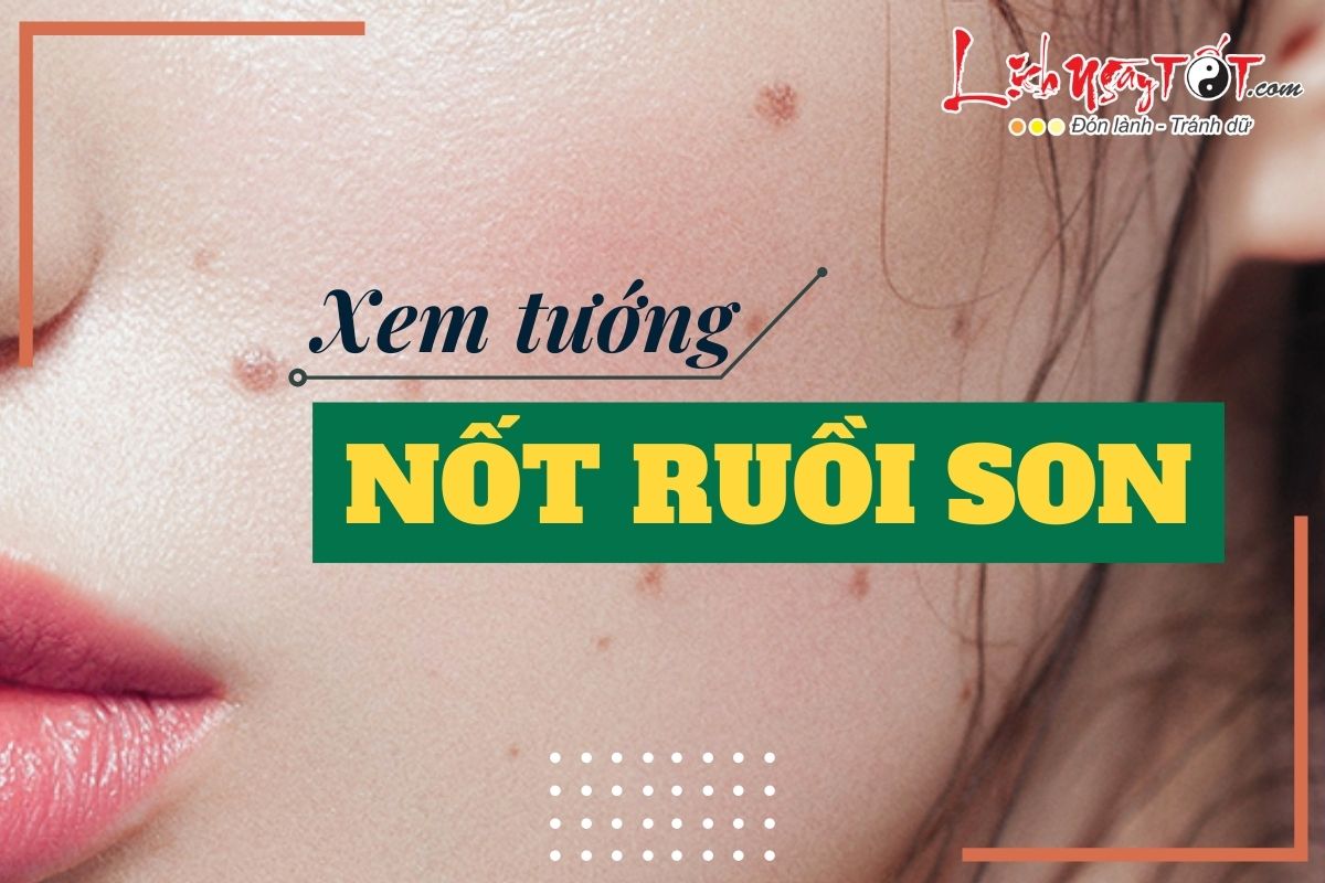 NỐT RUỒI SON thực sự có đem lại vận đỏ và may mắn cho chủ nhân?