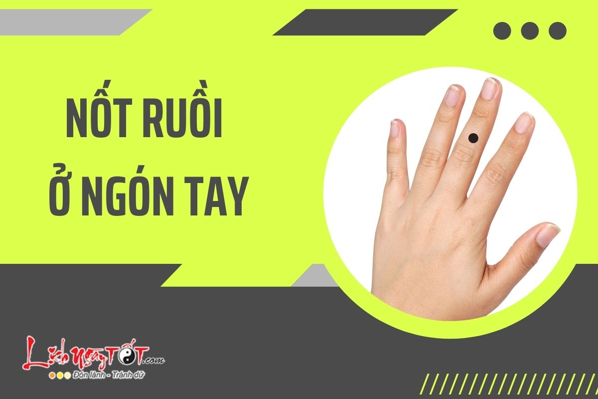 Giải mã tất tần tật về nốt ruồi trên ngón tay