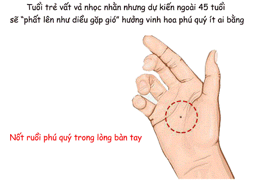 Not ruoi nam trong long ban tay