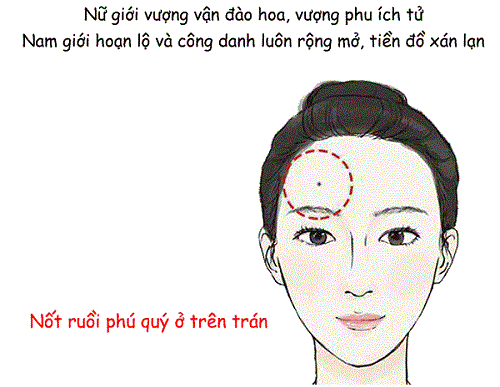 Not ruoi o tren tran duoc coi la quy tuong