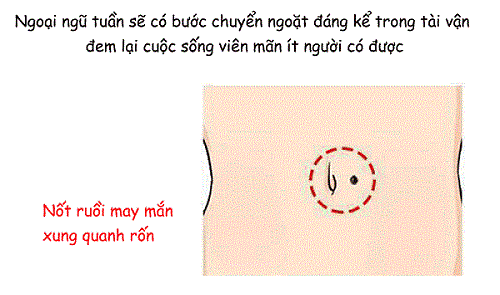 Not ruoi o xung quanh ron