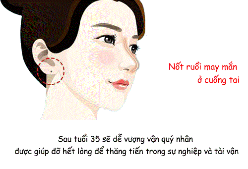 Vi tri not ruoi o cuong tai