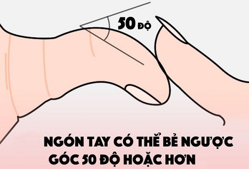 Dieu chua tung cong bo ve tuong ngon tay cai be nguoc hinh anh 2