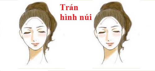 Hình dáng trán khác nhau, cá tính cũng không đồng nhất