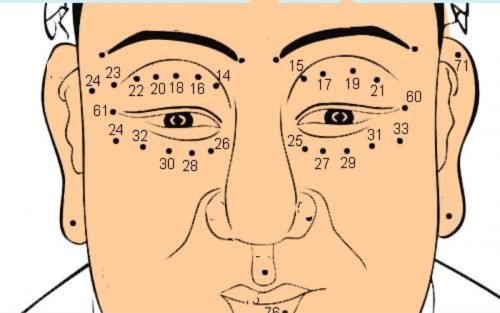 Những vị trí nốt ruồi trên mắt