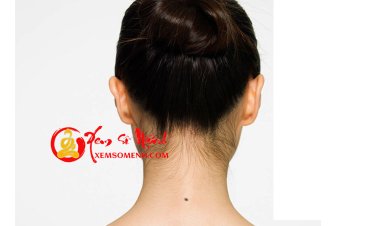 Ý Nghĩa Nốt Ruồi Ở Sau Gáy Chính Xác Nhất