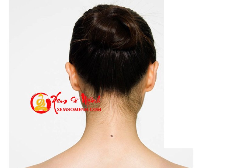 Ý Nghĩa Nốt Ruồi Ở Sau Gáy Chính Xác Nhất